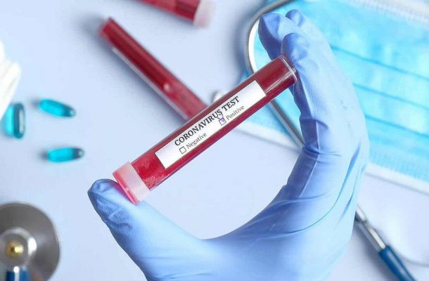 کرونا | ۷۵درصد مبتلایان به کرونا در خوزستان بیماری زمینه ای دارند کرونا | ۷۵درصد مبتلایان به کرونا در خوزستان بیماری زمینه ای دارند